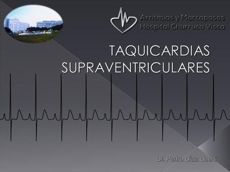 Se definen así a aquellas taquicardias cuyo sitio de origen del impulso o circuito de re-entrada se origina por encima de la bifurcación del Haz de His.