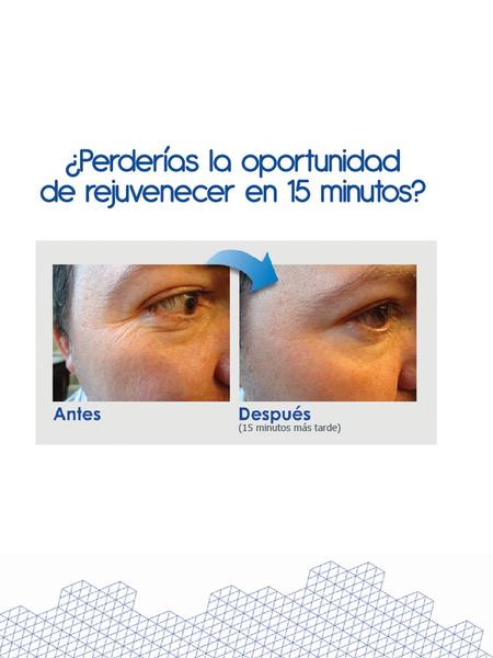 Cuántos pacientes tiene con: Bodas Viajes Eventos especiales Urgencia de resultados inmediatos Miedo a agujas de jeringas Evitan procedimientos (desconocimiento,