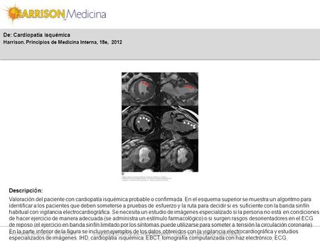 Fecha de descarga: 5/31/2016 Copyright © McGraw-Hill Education. Todos los derechos reservados. Valoración del paciente con cardiopatía isquémica probable.