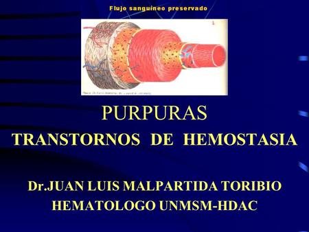 PURPURAS TRANSTORNOS DE HEMOSTASIA Dr.JUAN LUIS MALPARTIDA TORIBIO HEMATOLOGO UNMSM-HDAC.