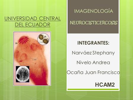 UNIVERSIDAD CENTRAL DEL ECUADOR INTEGRANTES: Narváez Stephany Nivelo Andrea Ocaña Juan Francisco HCAM2 NEUROCISTICERCOSIS IMAGENOLOGÍA.