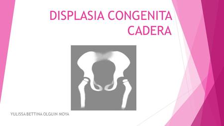 DISPLASIA CONGENITA CADERA YULISSA BETTINA OLGUIN MOYA.