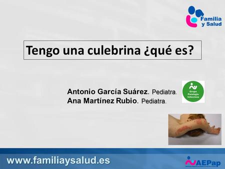 Tengo una culebrina ¿qué es? Pediatra Antonio García Suárez. Pediatra. Pediatra Ana Martínez Rubio. Pediatra.
