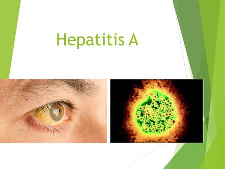Hepatitis A. Definición  Es una infección aguda, en ocasiones asintomático que produce inflamación y necrosis hepática en forma autolimitada, que nunca.