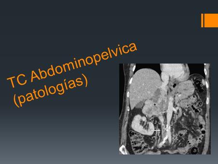 TC Abdominopelvica (patologías). Traumatismos  Imagen axial por tomografía computarizada con contraste que muestra una extravasación activa de contraste.