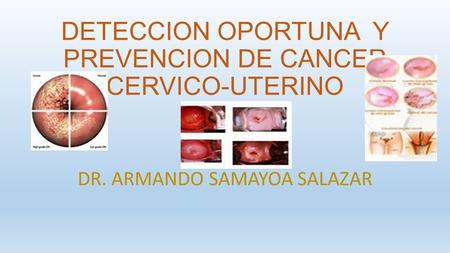 DETECCION OPORTUNA Y PREVENCION DE CANCER CERVICO-UTERINO DR. ARMANDO SAMAYOA SALAZAR.