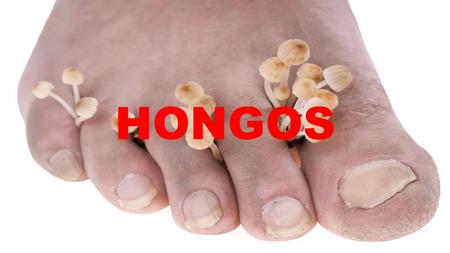 HONGOS. ¿ Que son ? ¿ Como se originan ? -Microorganismos hialinos -Queratinofilicos -Queratinoliticos - Contacto directo Superficies mohosas, ropa sintética,