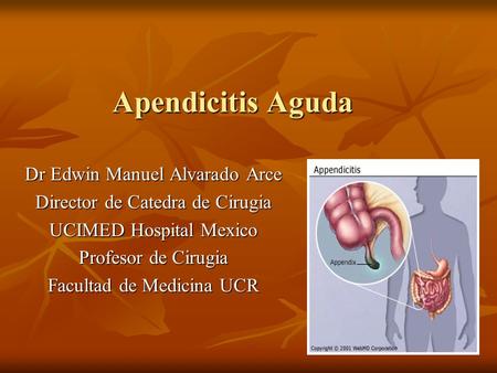Apendicitis Aguda Dr Edwin Manuel Alvarado Arce