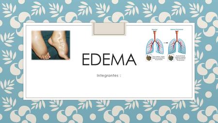 EDEMA Integrantes :. EDEMA ◦ El edema es el aumento de volumen del líquido en el intersticio que se manifiesta clínicamente por un hoyuelo al presionar.