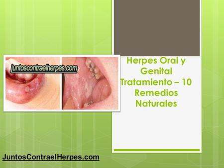 Herpes Oral y Genital Tratamiento – 10 Remedios Naturales JuntosContraelHerpes.com.