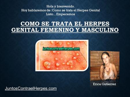 COMO SE TRATA EL HERPES GENITAL FEMENINO Y MASCULINO Hola y bienvenido. Hoy hablaremos de :Como se trata el Herpes Genital Listo... Empecemos JuntosContraelHerpes.com.