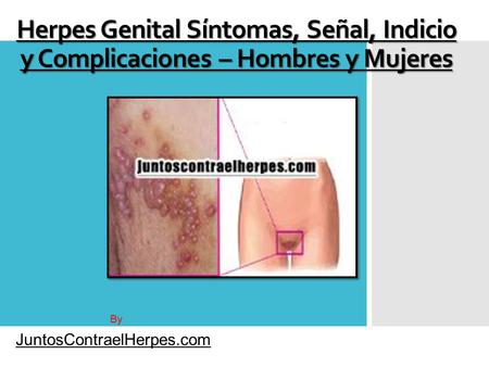 Herpes Genital Síntomas, Señal, Indicio y Complicaciones – Hombres y Mujeres By JuntosContraelHerpes.com.