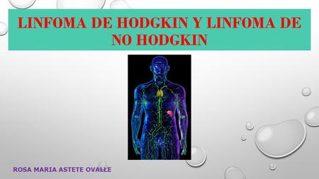 LINFOMA DE HODGKIN Y LINFOMA DE NO HODGKIN ROSA MARIA ASTETE OVALLE.