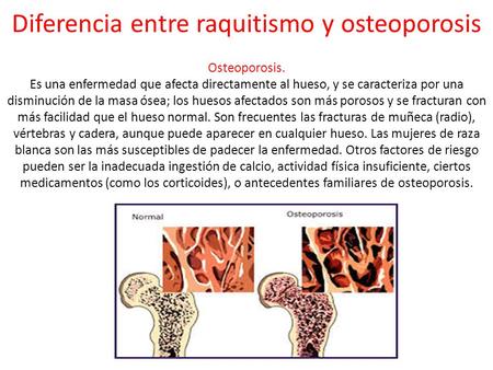 Diferencia entre raquitismo y osteoporosis Osteoporosis. Es una enfermedad que afecta directamente al hueso, y se caracteriza por una disminución de la.