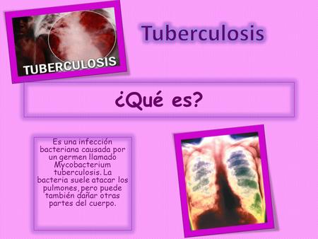 ¿Qué es? Es una infección bacteriana causada por un germen llamado Mycobacterium tuberculosis. La bacteria suele atacar los pulmones, pero puede también.