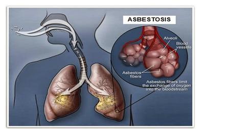 DIAGNOSTICO PREVENCION enfermedades causadas por inhalación de asbesto se pueden evitar disminuyendo al máximo el polvo y las fibras de asbesto en.