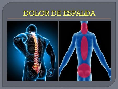 DOLOR DE ESPALDA.