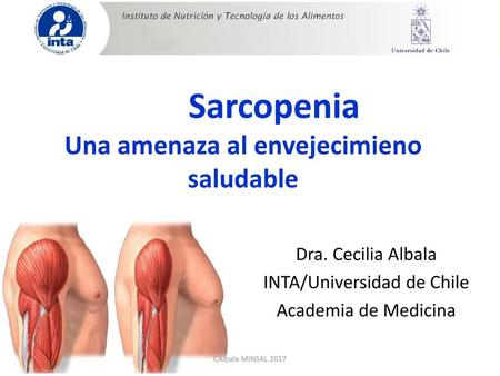 Sarcopenia Una amenaza al envejecimieno saludable