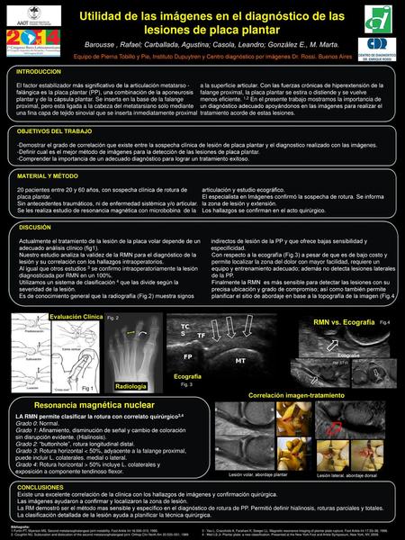 Resonancia magnética nuclear