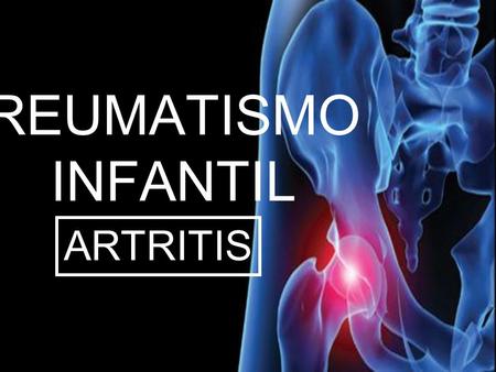 REUMATISMO INFANTIL ARTRITIS. Reumatismo: Se define como el conjunto de enfermedades inflamatorias y degerenativas que afectan las estructuras y articulaciones.