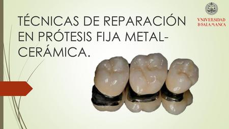 TÉCNICAS DE REPARACIÓN EN PRÓTESIS FIJA METAL-CERÁMICA.
