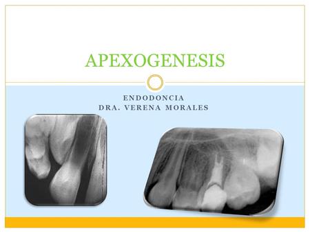 Endodoncia Dra. Verena morales