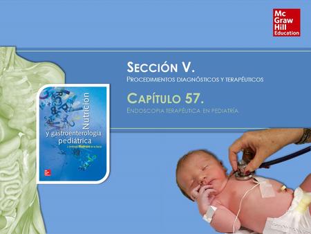 S ECCIÓN V. P ROCEDIMIENTOS DIAGNÓSTICOS Y TERAPÉUTICOS C APÍTULO 57. E NDOSCOPIA TERAPÉUTICA EN PEDIATRÍA.