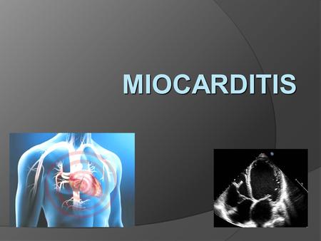 MIOCARDITIS.