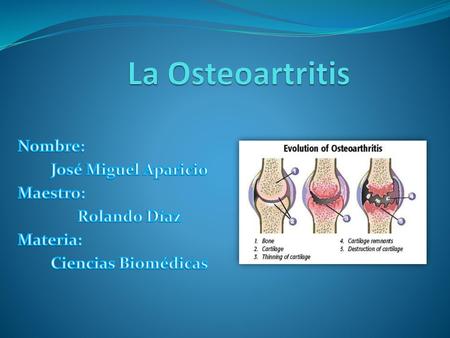 La Osteoartritis Nombre: José Miguel Aparicio Maestro: Rolando Díaz