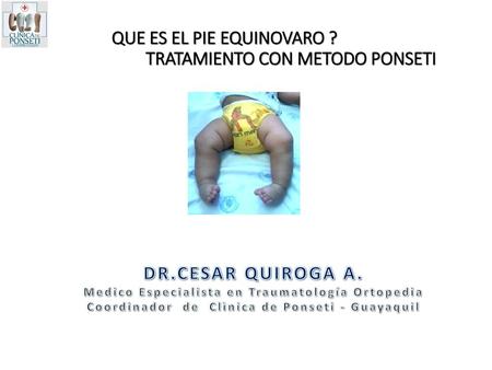 QUE ES EL PIE EQUINOVARO ? TRATAMIENTO CON METODO PONSETI