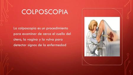 COLPOSCOPIA La colposcopia es un procedimiento para examinar de cerca el cuello del útero, la vagina y la vulva para detectar signos de la enfermedad.