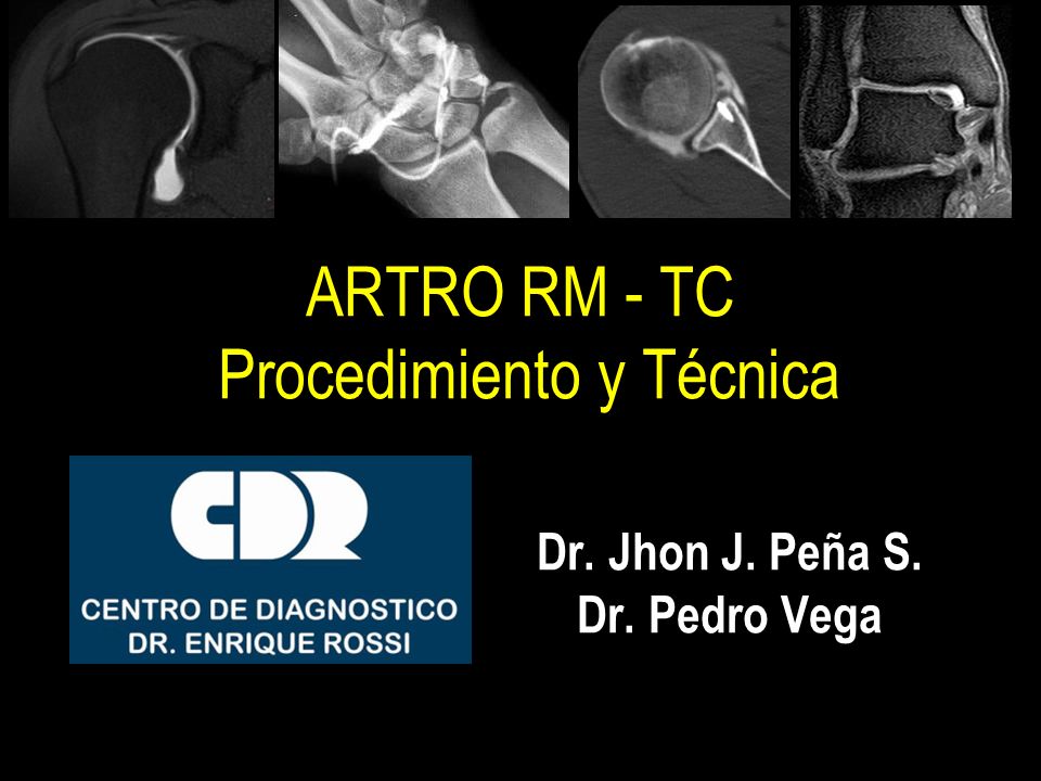 ARTRO RM - TC Procedimiento y Técnica - ppt descargar