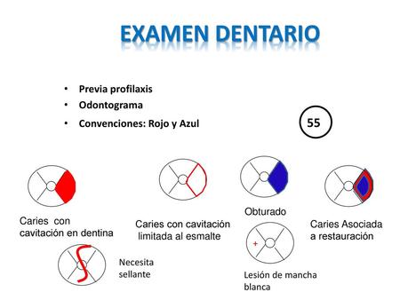 EXAMEN DENTARIO Previa profilaxis Odontograma