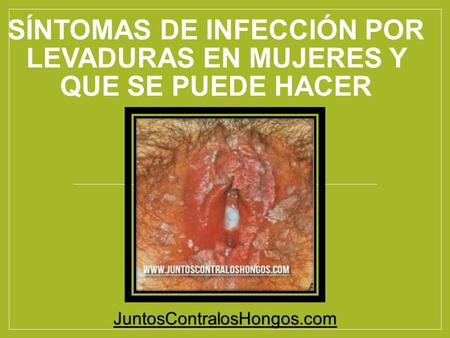 como curar la infección de levadura naturalmente
