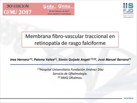 Membrana fibro-vascular traccional en retinopatía de rasgo falciforme