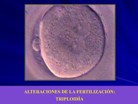 ALTERACIONES DE LA FERTILIZACIÓN: