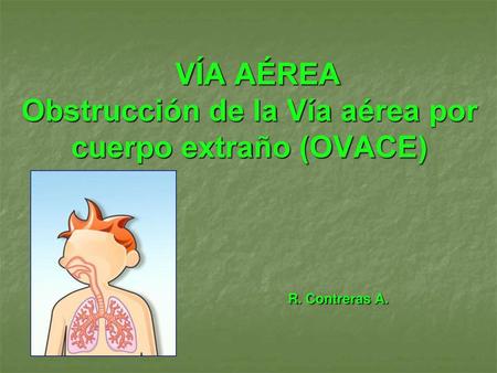 VÍA AÉREA Obstrucción de la Vía aérea por cuerpo extraño (OVACE) R