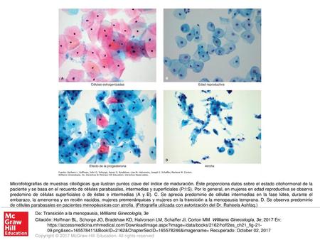 Microfotografías de muestras citológicas que ilustran puntos clave del índice de maduración. Éste proporciona datos sobre el estado citohormonal de la.
