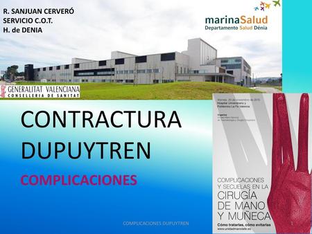 CONTRACTURA DUPUYTREN