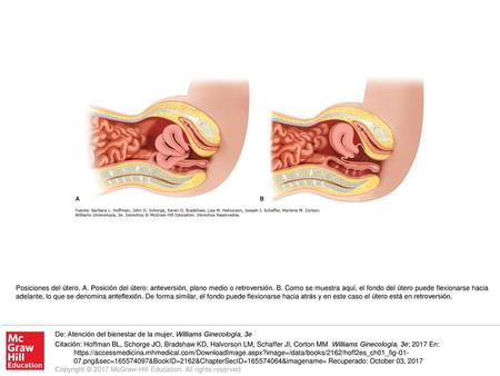 Posiciones del útero. A. Posición del útero: anteversión, plano medio o retroversión. B. Como se muestra aquí, el fondo del útero puede flexionarse hacia.
