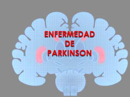 ENFERMEDAD DE PARKINSON.