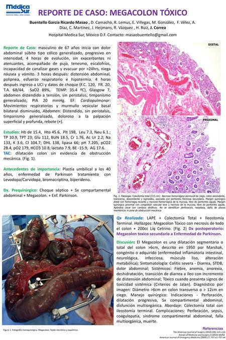 REPORTE DE CASO: MEGACOLON TÓXICO