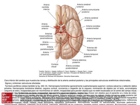Territorio central. Síndrome talámico: pérdida de sensibilidad (todas las modalidades), dolor y disestesias espontáneos, coreoatetosis, temblor intencional,