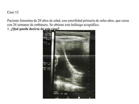 Caso 12 Paciente femenina de 29 años de edad, con esterilidad primaria de ocho años, que cursa con 24 semanas de embarazo. Se obtiene este hallazgo ecográfico.