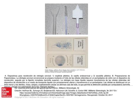 A. Dispositivos para recolección de citología cervical: 1) espátula plástica, 2) cepillo endocervical y 3) escobilla plástica. B. Preparaciones de Papanicolaou.