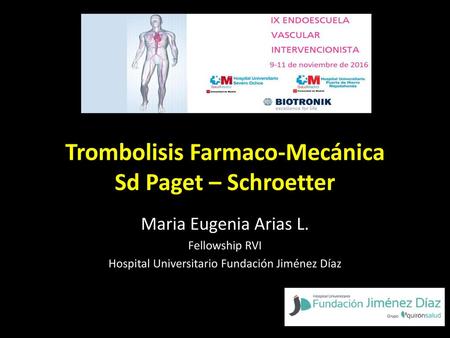 Trombolisis Farmaco-Mecánica Sd Paget – Schroetter