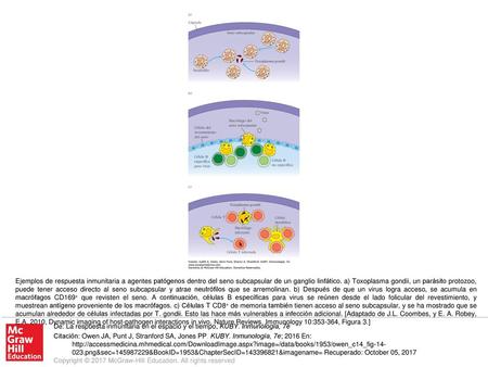 Ejemplos de respuesta inmunitaria a agentes patógenos dentro del seno subcapsular de un ganglio linfático. a) Toxoplasma gondii, un parásito protozoo,