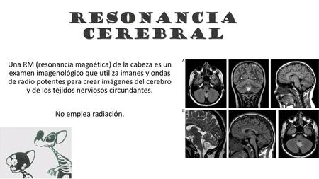 RESONANCIA CEREBRAL Una RM (resonancia magnética) de la cabeza es un examen imagenológico que utiliza imanes y ondas de radio potentes para crear imágenes.