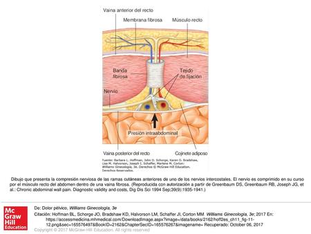 Dibujo que presenta la compresión nerviosa de las ramas cutáneas anteriores de uno de los nervios intercostales. El nervio es comprimido en su curso por.