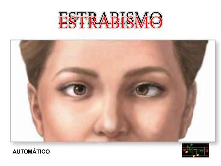 ESTRABISMO ESTRABISMO